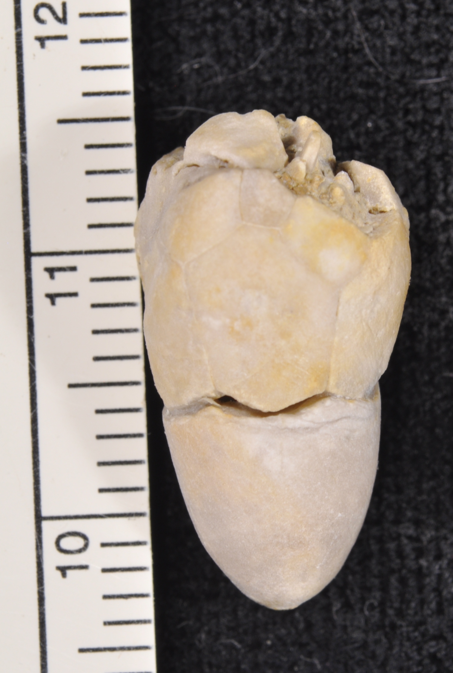 Agassizocrinus